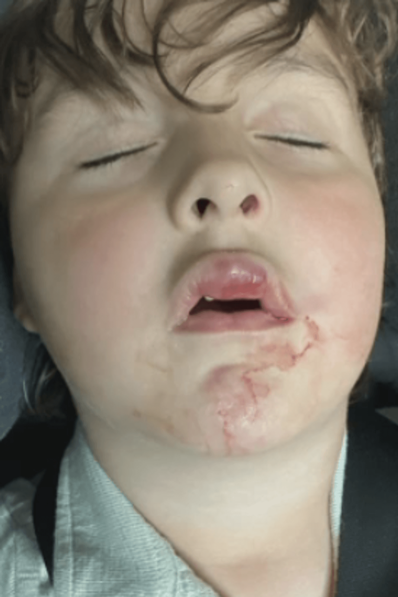 Eula Elementary School Fails To Notify Mother After Autistic Child Injured On Playground