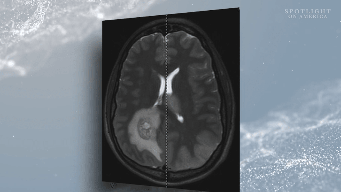 brain scan for short crossword clue