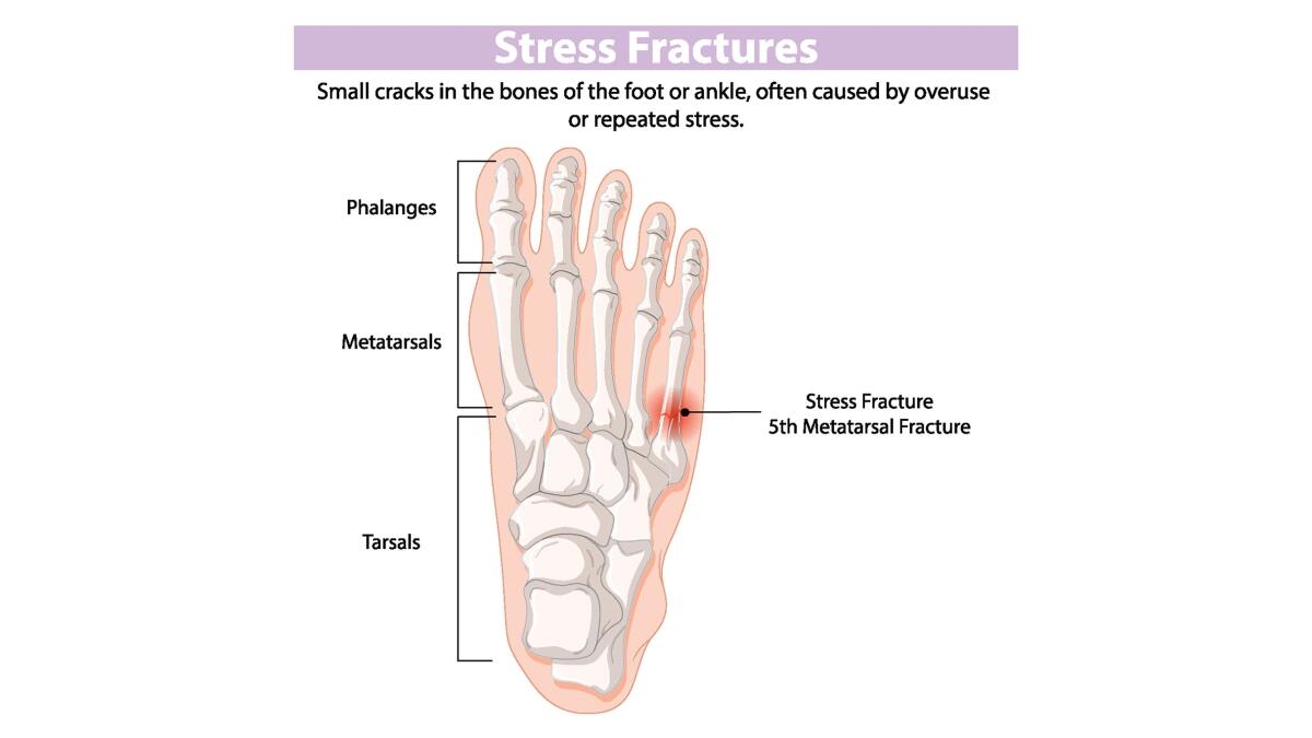 ankle bone crossword puzzle clue