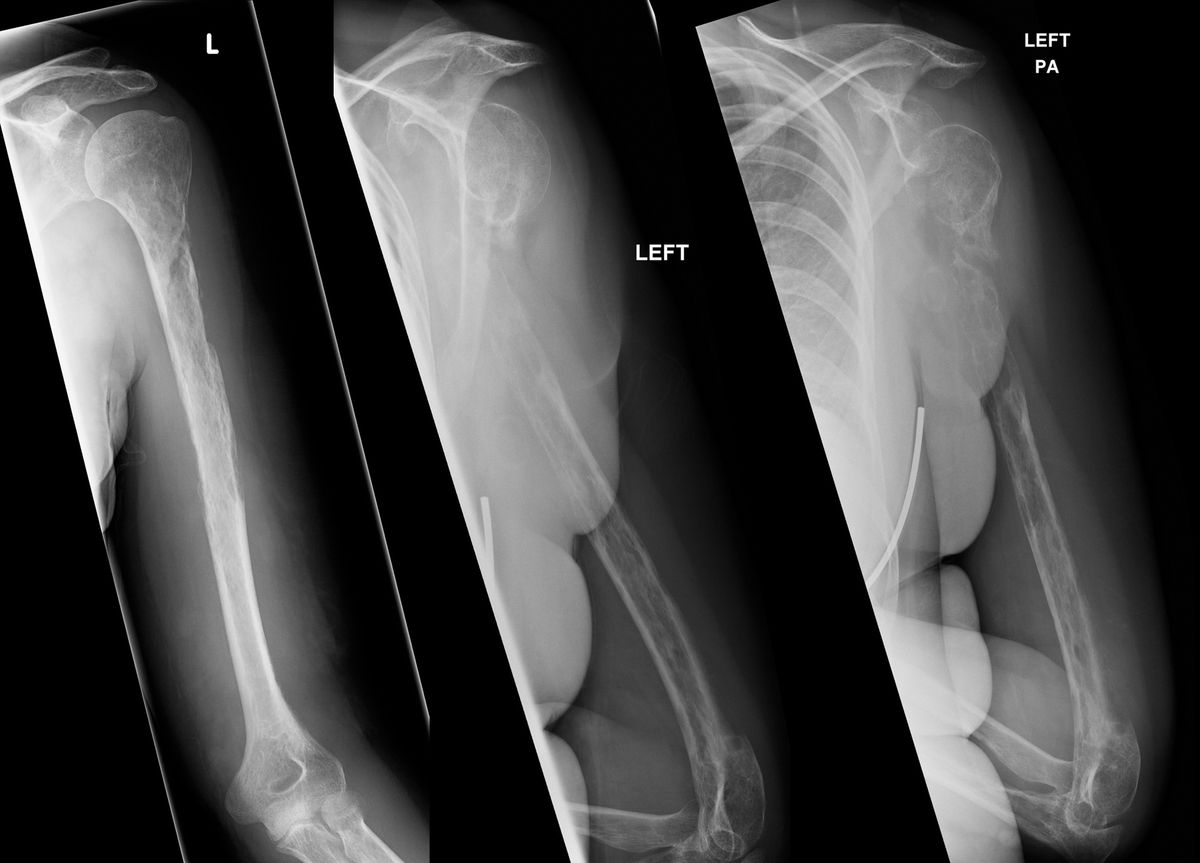 Woman s Bones Vanish Before Doctors Eyes Live Science